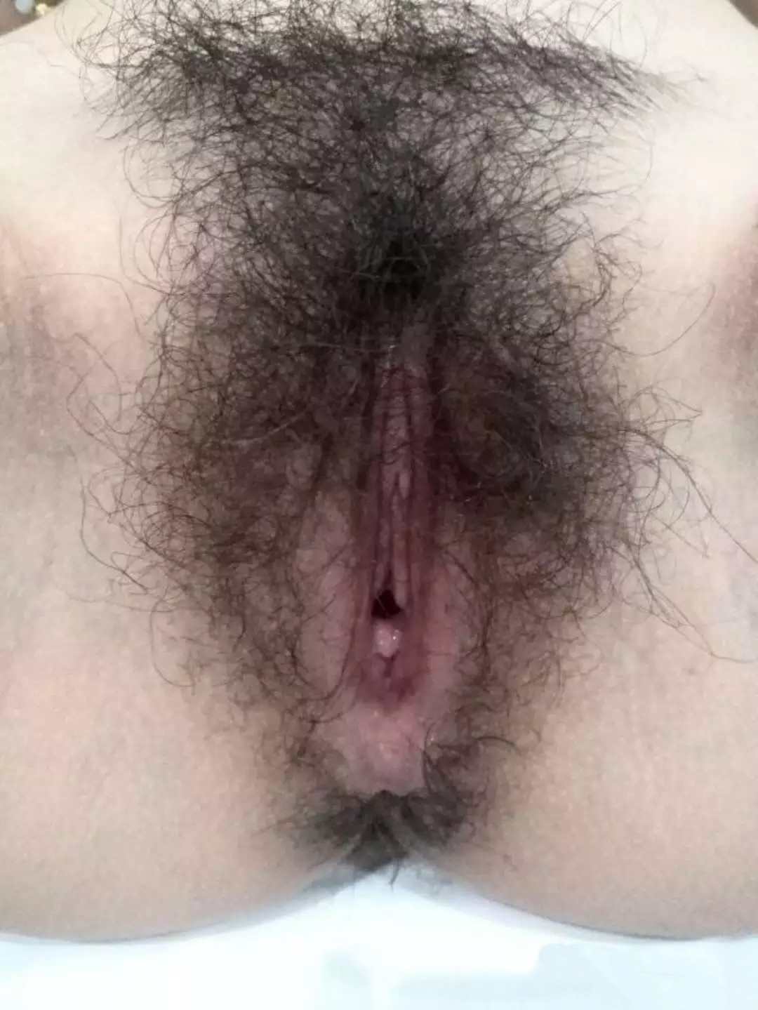 ขนหัวหน่าวเขียวชอุ่มมาก [16P]