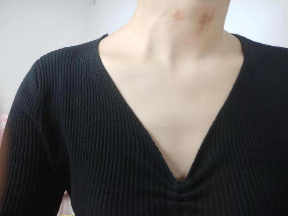 คอลเลกชันอดีตแฟนสาว［30P］